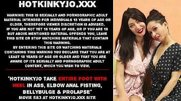 Play Stacy Bloom put in Hotkinkyjo ENTIRE FOOT WITH HEEL in ass, elbow anal fisting, bellybulge & prolapse